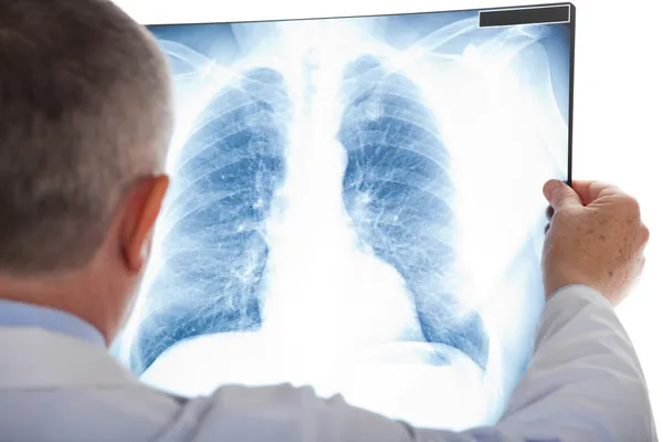 Старший врач, изучения рентгенография легких — стоковое фото