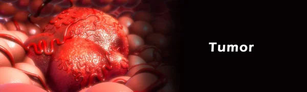 Опухолевые клетки в кровеносных сосудов — стоковое фото